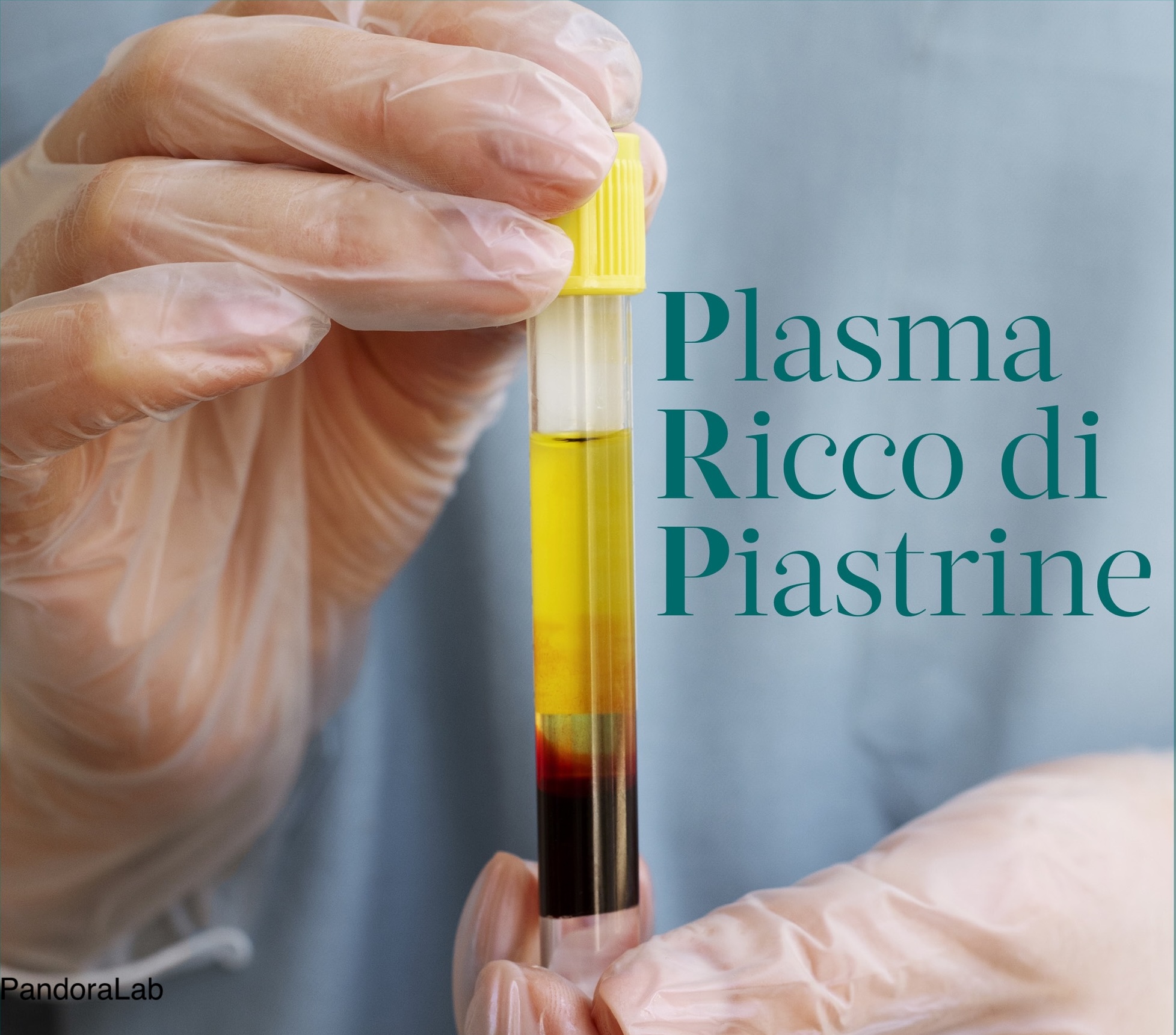 Plasma Ricco di Piastrine (PRP): basi biologiche, applicazioni cliniche e limiti